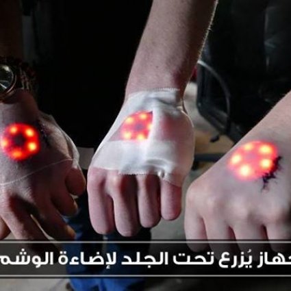 جهاز يزرع تحت الجلد لإضاءة الوشم!
