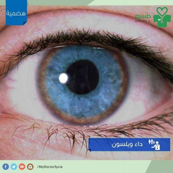 هل سمعت يوماً بمرض ويسلون؟