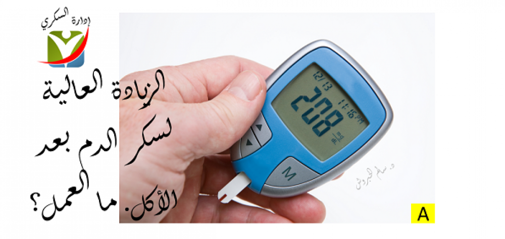 ما هو تحليل Hba1c بالتفصيل 2020 تحاليلي