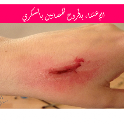 كيفية العناية بالجروح للمصابين بالسكري