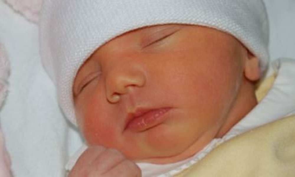 اليرقان الوليدي