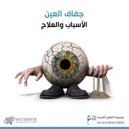 ما هي أسباب جفاف العين، وما علاجها؟