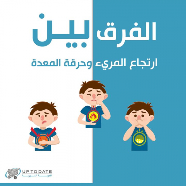 كيف يمكننا أن نمييز بين حرقة المعدة وارتجاع المريء؟