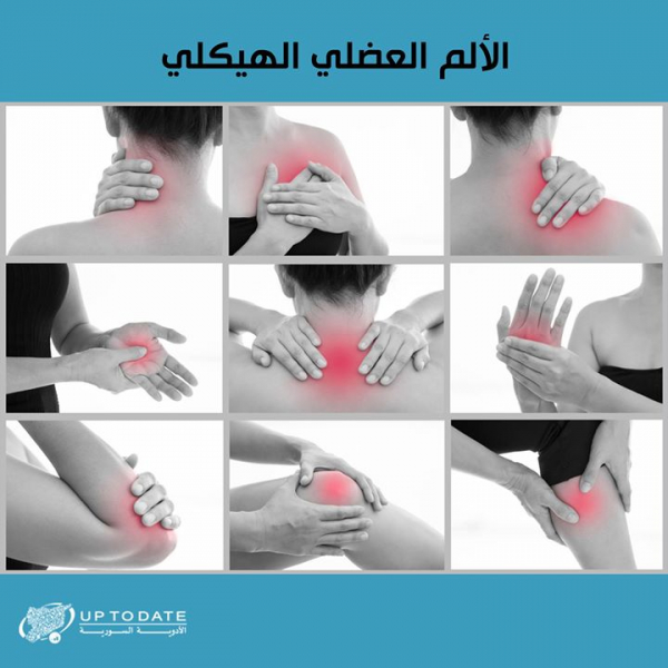 تساؤلات حول الألم العضلي الهيكلي؟