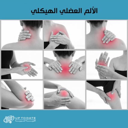 تساؤلات حول الألم العضلي الهيكلي؟
