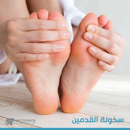 ما هي أسباب سخونة أو حرقة القدمين؟