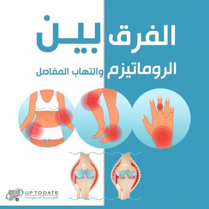 كيف يمكننا أن نمييز بين الروماتيزم والتهاب المفاصل العادي؟