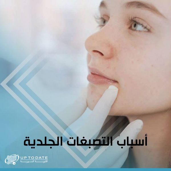أسباب التصبغات الجلدية