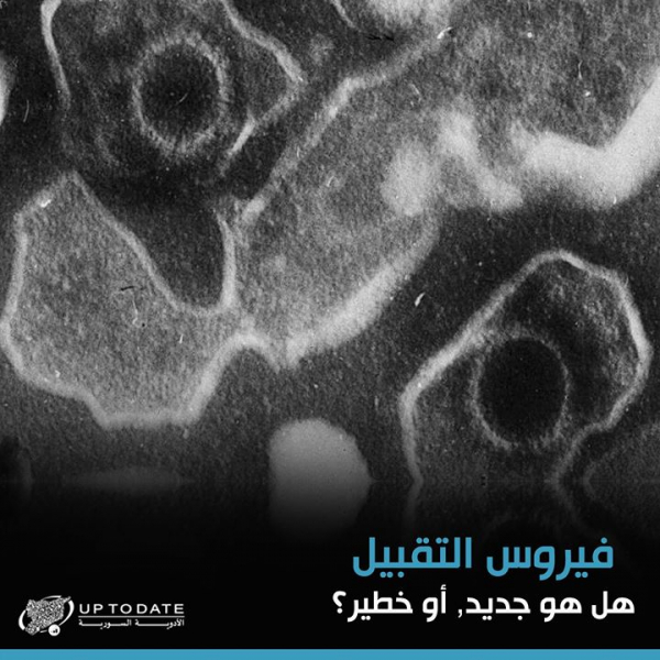 فيروس التقبيل