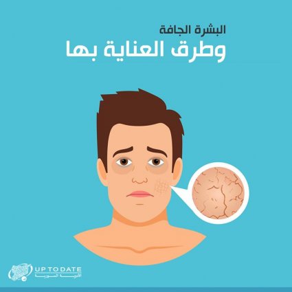 كيفية العناية بالبشرة الحافة