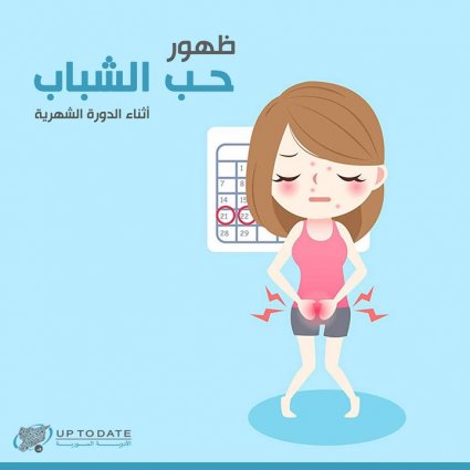 أسباب ظهور حب الشباب أثناء الدورة الشهرية