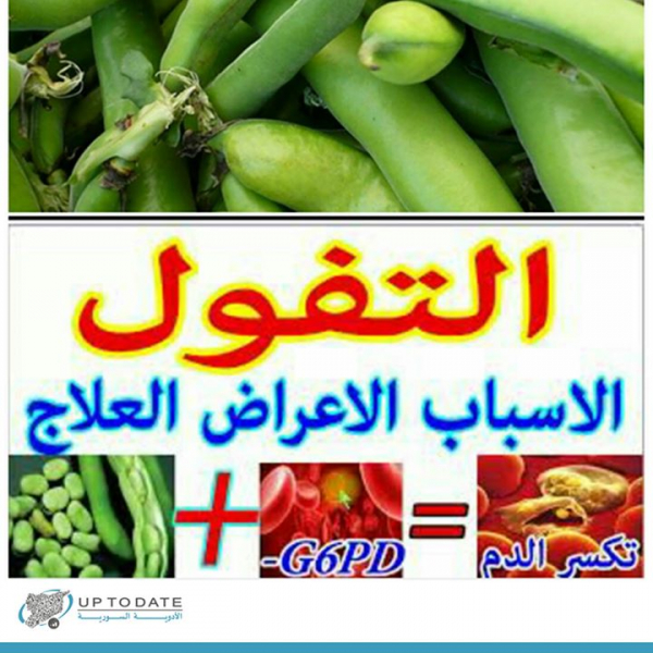 ما هو مرض التفول؟