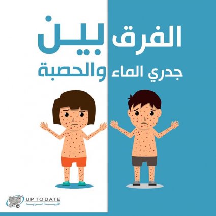 ما الفرق بين جدري الماء والحصبة؟