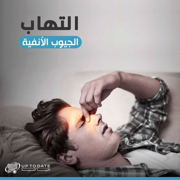 التهاب الجيوب الأنفية