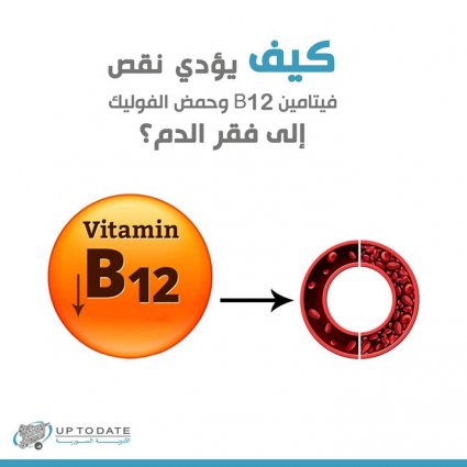 كيف يؤدي نقص فيتامين B12 إلى فقر الدم؟