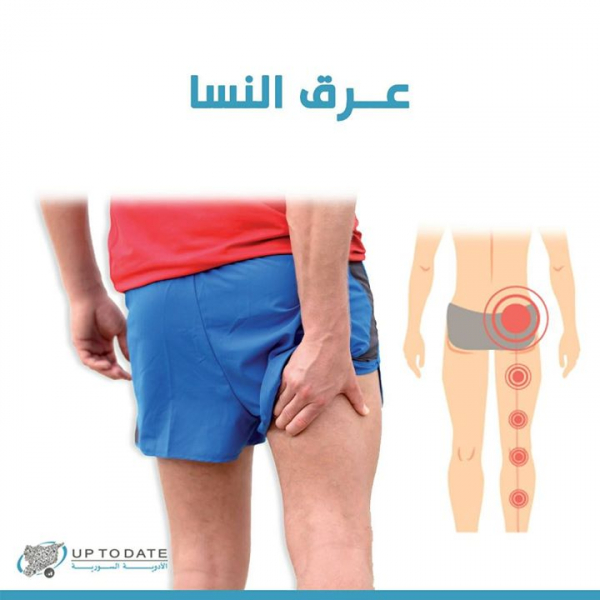 ما هو سبب عرق النسا بالعربيك