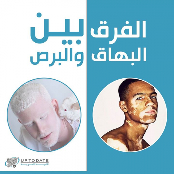 حمية البهاق نظام غذائي فعال لعلاج البهاق