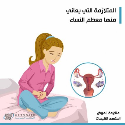 متلازمة المبايض متعددة الكيسات