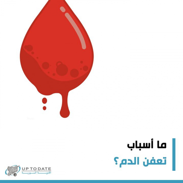 ما هي أسباب تعفن الدم؟
