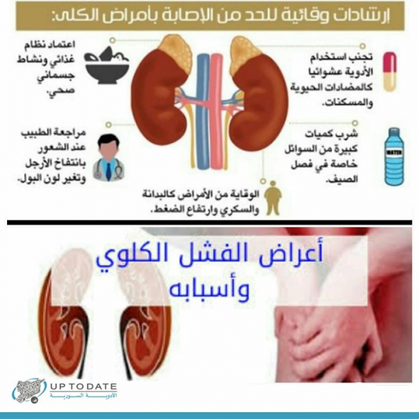 ما هي أعراض الفشل الكلوي بالعربيك
