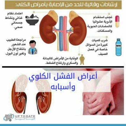 ما هي أعراض الفشل الكلوي؟