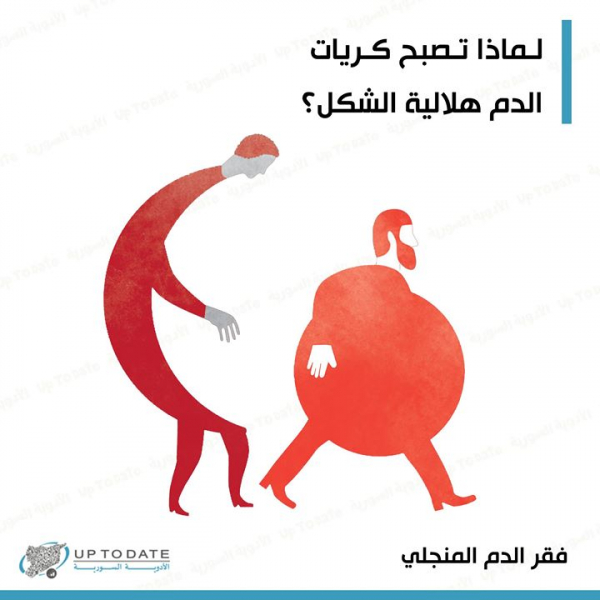 لماذا تصبح كريات الدم هلالية الشكل بالعربيك