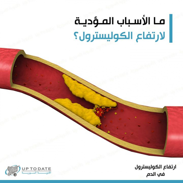 ما الأسباب المؤدية لارتفاع الكوليسترول؟