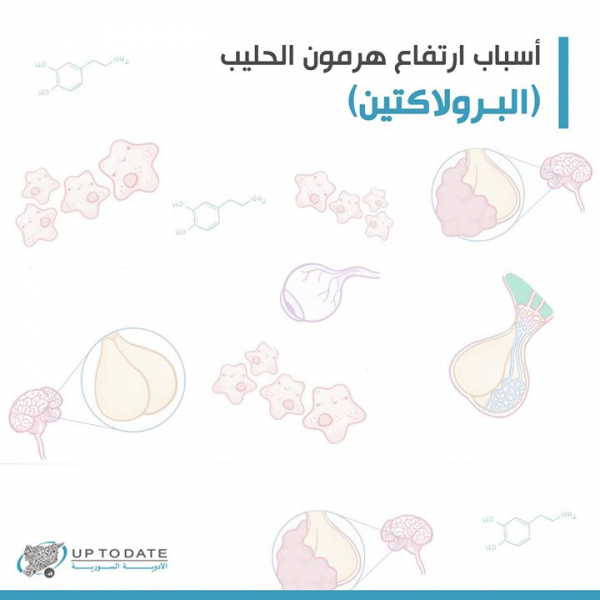 أسباب زيادة هرمون الحليب موضوع