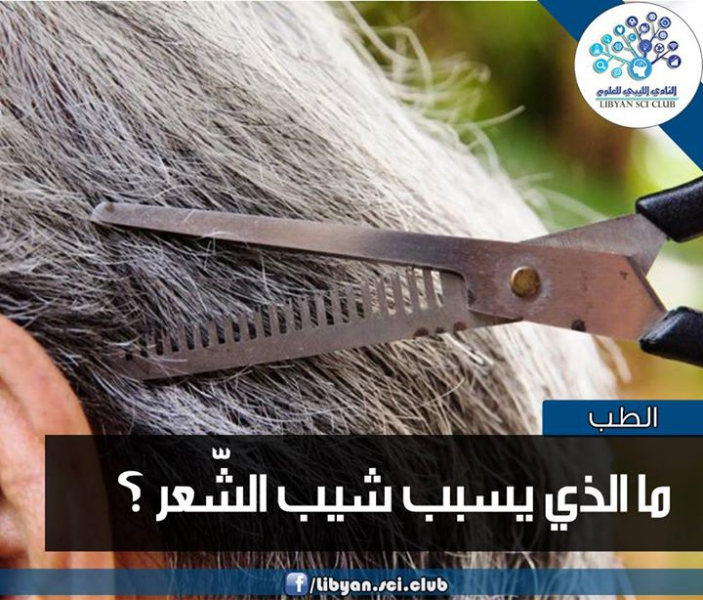 ما الذي يسبب شيب الشعر في الصغر؟