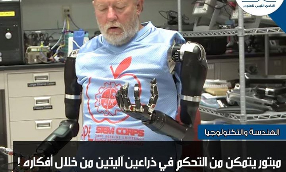 مبتور يتحكم بذراعيه الآليتين من خلال أفكاره!