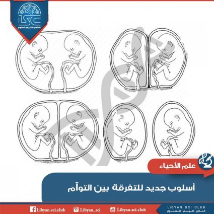 كيف نفرق بين التوأم؟