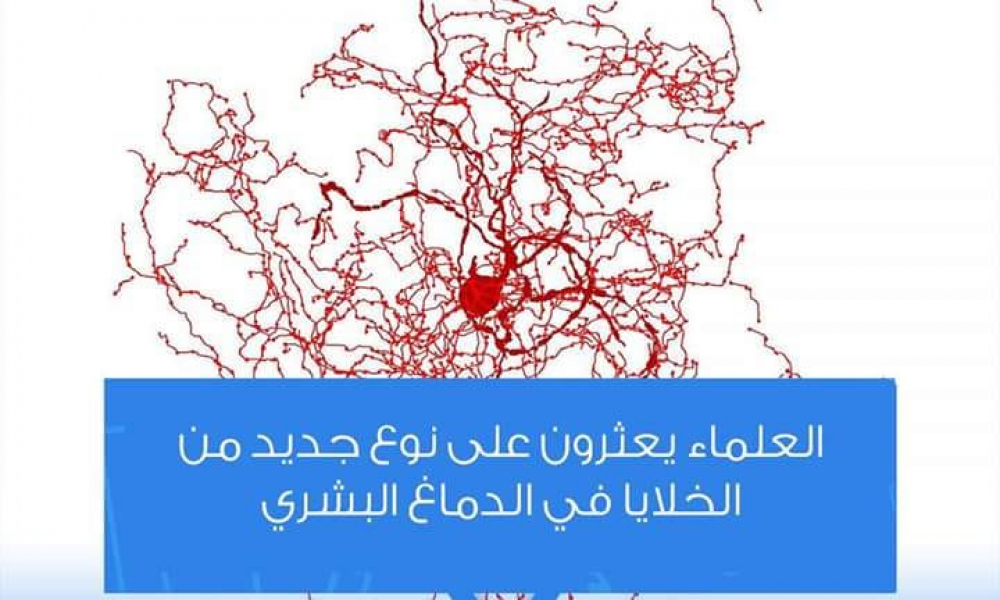 ما الذي يجعل عقل الانسان مميز عن باقي الكائنات الحية؟