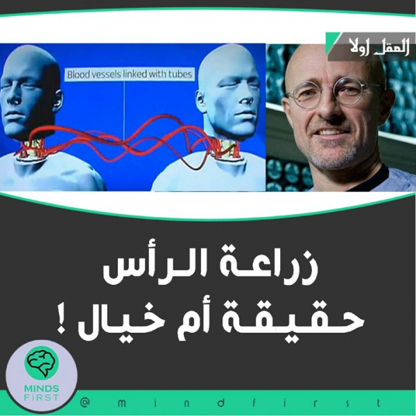 أول زراعة رأس في العالم