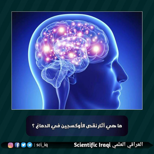 ما هي آثار نقص الأوكسجين في الدماغ؟