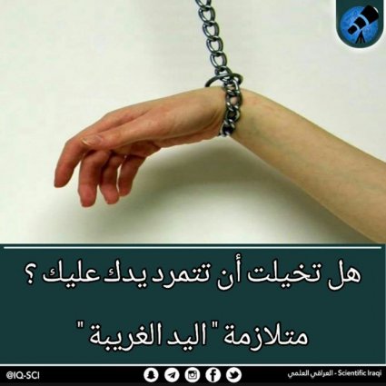 مُتلازمة اليد الغريبة!