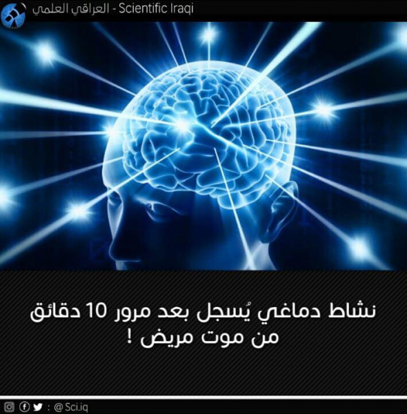 نشاطٌ دماغي يُسجل بعد مرور 10 دقائق من موت المريض