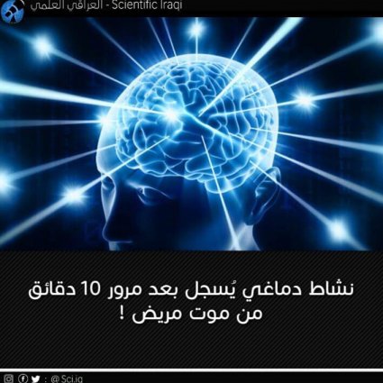 نشاطٌ دماغي يُسجل بعد مرور 10 دقائق من موت المريض