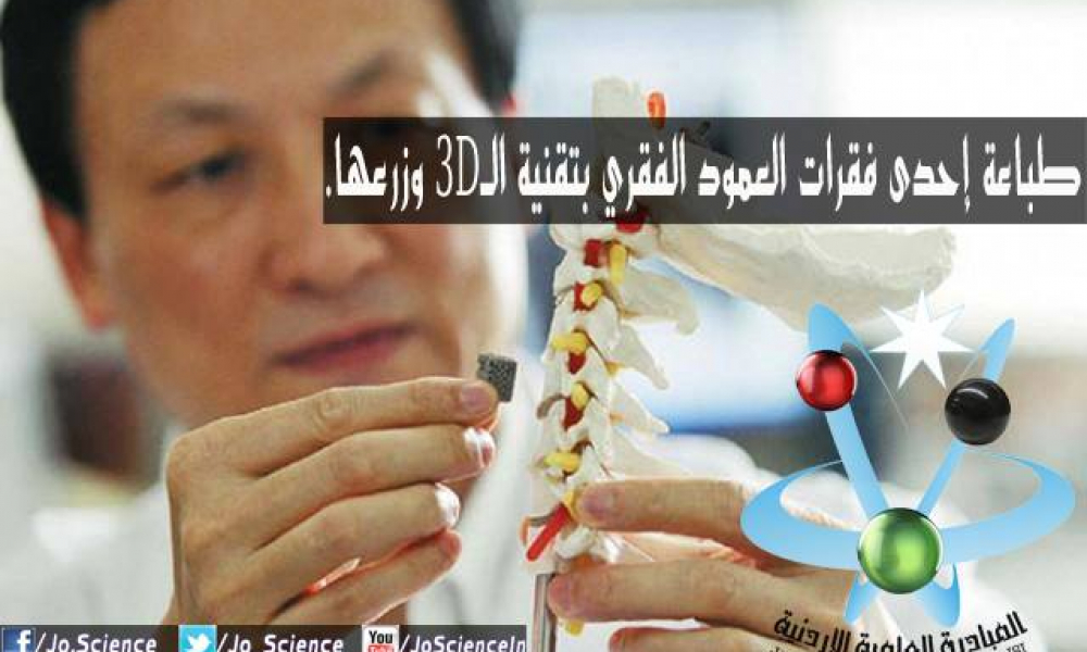 طباعة إحدى فقرات العمود الفقري بتقنية الـ3D وزرعها!